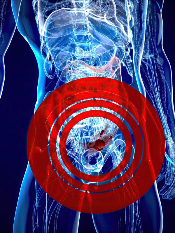 urologie prostata laser
