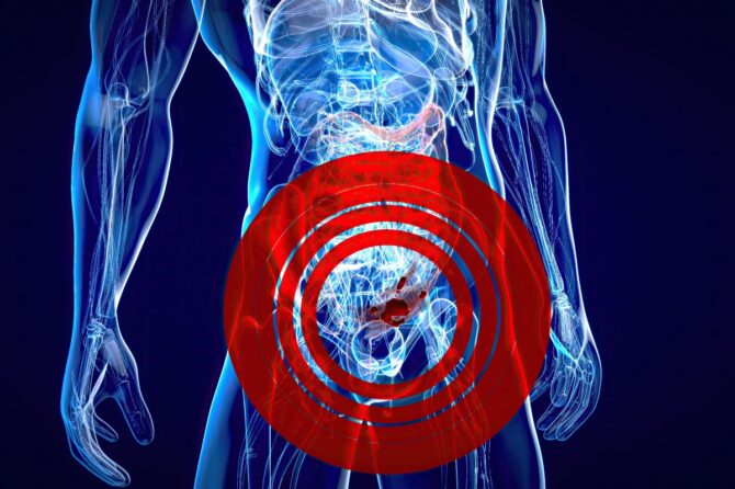 Urologie laser pentru prostată