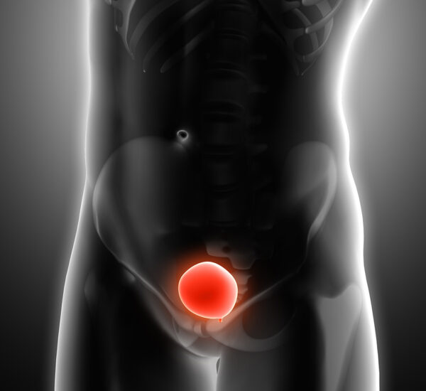 anomalii anatomice infertilitate anomalii anatomice infertilitate