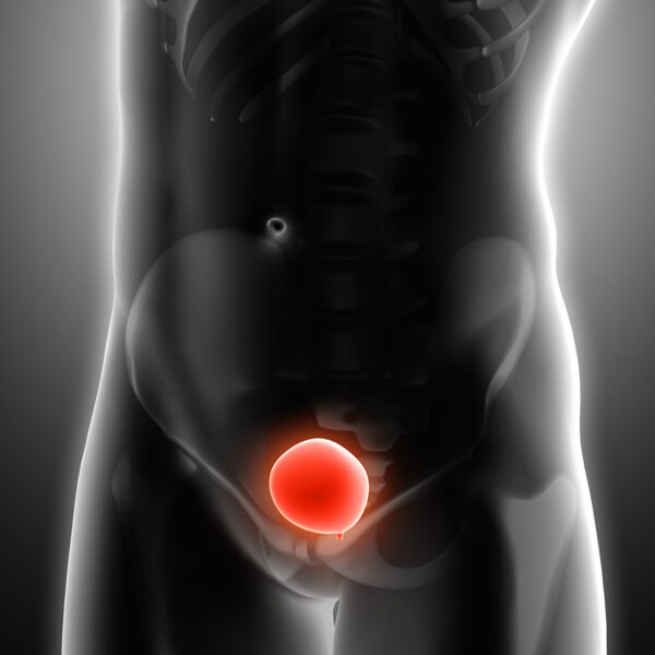 anomalii anatomice infertilitate