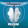 Terapia Rezūm pentru adenomul de prostată, fără internare
