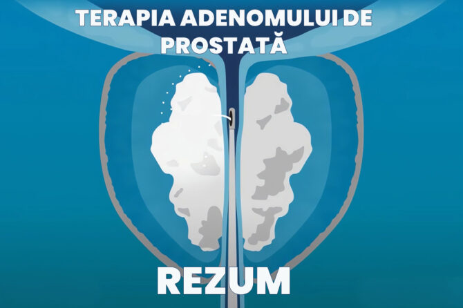 Terapia Rezūm pentru adenomul de prostată, fără internare